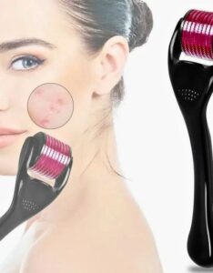540 Microneedle Scar Derma Roller Dermaroller Micro Needle Skin Care Therapy 0.75mm