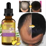 DISAAR BEAUTY Hair Growth Essential Oil 30g - Image 4