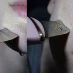 Deep Cleansing Device for the Skin - Image 9