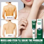 Cream Skin Topical Cream Moisturizes And Hydrates And Reduces Itchiness Herb Cream 20g - Image 3
