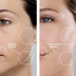 Facial Hair Remover Machine For Men & Women - Image 3