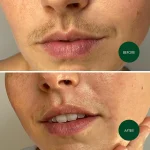 Facial Wax Strips Hair Remover - Image 5