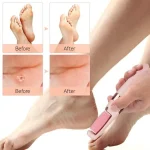 Electric Pedi Callous Remover, Professional Electric Foot Grinder File Callus Dead Skin Remover Pedicure Tool - Image 4